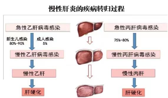 【健康科普】世界肝炎日——堅持早預(yù)防，加強檢測發(fā)現(xiàn)，規(guī)范抗病毒治療